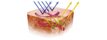 Narrow Band Imaging