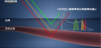 Red Dichromatic Imaging