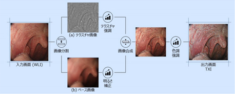 TeXture and color enhancement Imaging