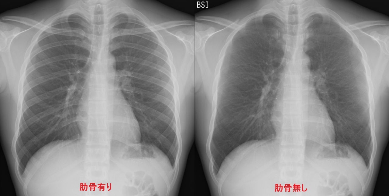 X線診断